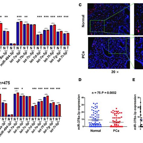 Circpdhx Had A Negative Correlation With Mir 378a 3p Expression In