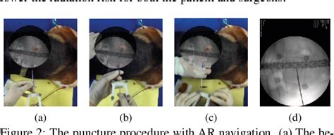 Figure 2 From Augmented Reality Based Surgical Navigation For