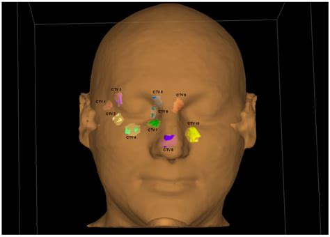 Jpm Free Full Text Personalized Superficial Hdr Brachytherapy