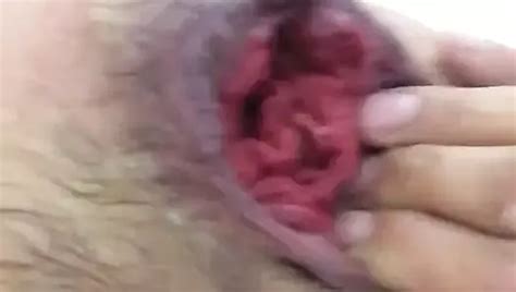 Mou Fisting Free Solo Man Porn Video XHamster