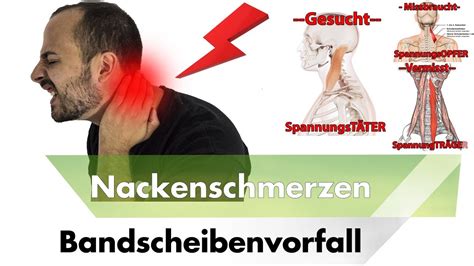 Nackenschmerzen Hws Bandscheibenvorfall Symptome Ursachen