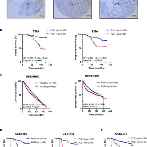 UP Regulation Of PUS1 Correlated With Poor Prognosis For Patients With