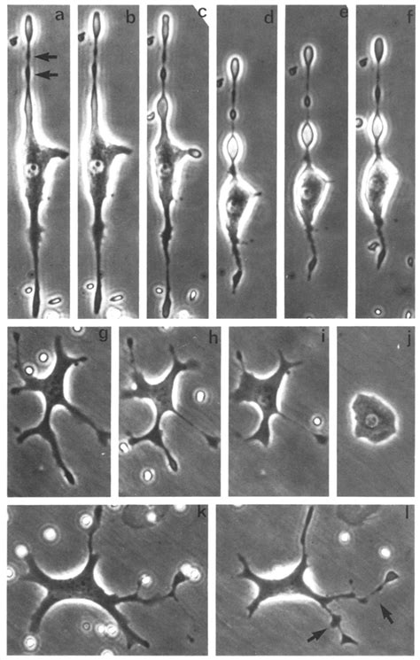 Phase Contrast Micrographs Showing The Effects Ofcytochalasin 10