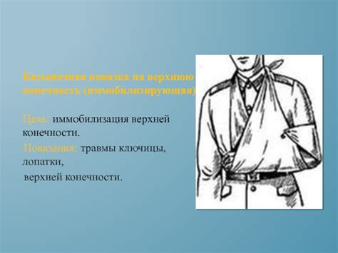 Десмургия. Наложение повязок на конечности