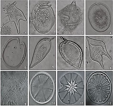 Dinoflagellates 1 8 And Diatoms 9 12 Species Found At The Three Download Scientific Diagram