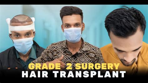 Hair Transplant In Gwalior Best Results Cost Of Hair Transplant In