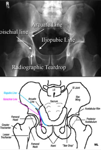 Pelvis Flashcards Quizlet