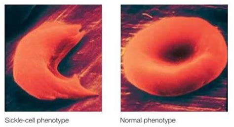 Introduction Human Hemoglobin Hba And The Hbb Gene