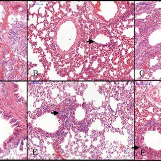 Histological Analysis Of Lung Tissues Representative Image From