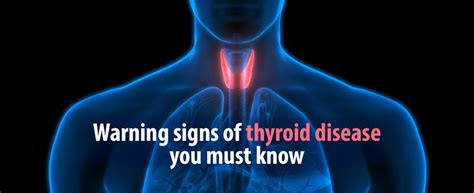 Warning Signs Of Thyroid Disease You Must Know Kdah Blog Health And Fitness Tips For Healthy Life