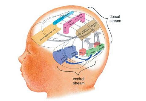 A Team Approach To Cortical Visual Impairment Cvi In Schools