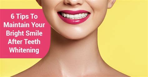 Tips For Keeping Your Teeth White After A Whitening Procedure Sierra