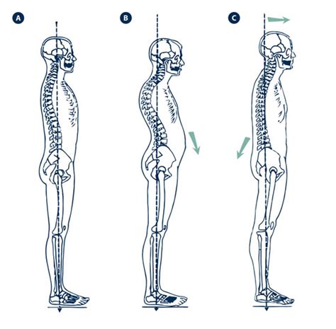 Postura Correcta De La Espalda Escuela De Espalda Unión De Mutuas