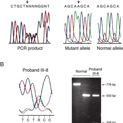 Detection Of Mutations In The CASR Gene A Left Panel Direct Sequence