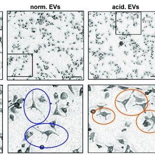 Influence Of Normal And Acidified EVs On The Keratinocytes