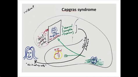 Capgras Syndrome Youtube