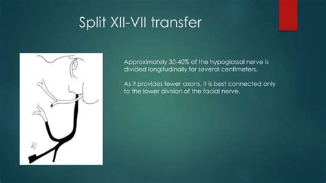 Management Of Bells Palsy Ppt