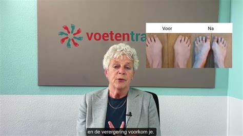 Gratis Oefeningen Van Voetentraining Voorkom Dat Je Hallux Valgus