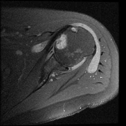 Radiology Quiz Radiopaedia Org