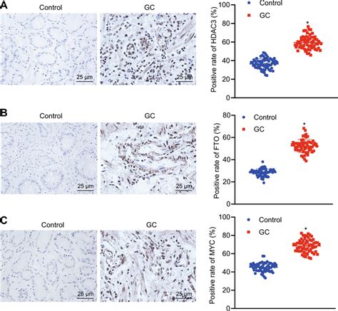 Expression Of HDAC3 FTO And MYC Proteins In GC And Adjacent Normal