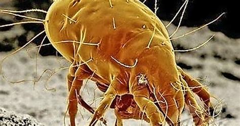 Cheese Mite Image Under Electron Microscope Album On Imgur