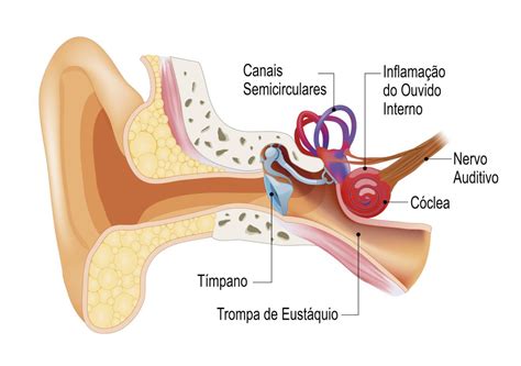 Doen As Do Labirinto Quais Os Sintomas E Tratamentos Otorrino Rio De