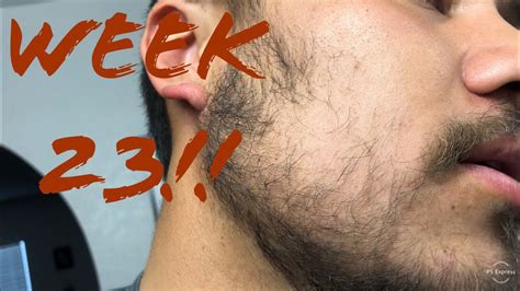 Minoxidil Beard Journey Week 23 Youtube