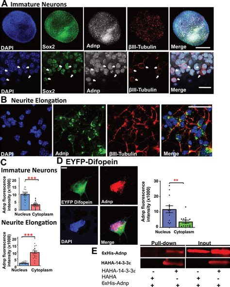 Adnp Localization Shifts From The Nucleus To The Cytoplasm As Cortical