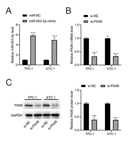 Full Article Exosomal Circular RNA Hsa Circ 007293 Promotes