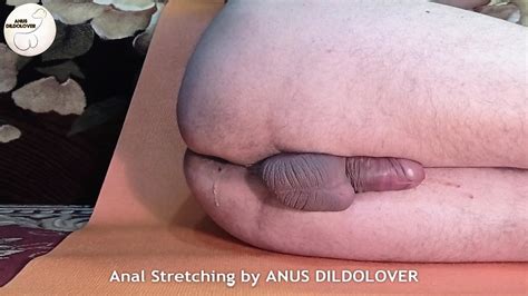Anal Stretching By Anus Dildolover