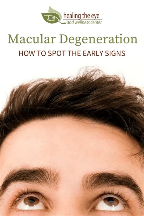 Macular Degeneration Symptoms How To Spot The Early Warning Signs Understand The Early Signs