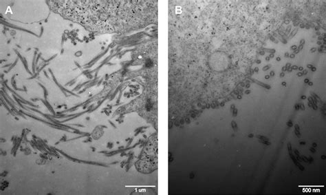 Transmission electron micrographs of negatively stained H9N2 virus ...