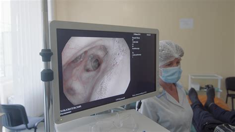 Ukraine. Lviv 10.05.2022 Lung endoscopy. doctors monitor the lungs with