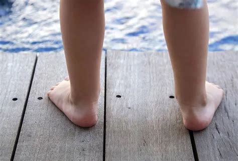 how to know if i have overpronation