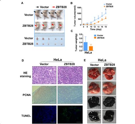 Zbtb28 Suppressed Tumorigenicity In Vivo A Representative Pictures