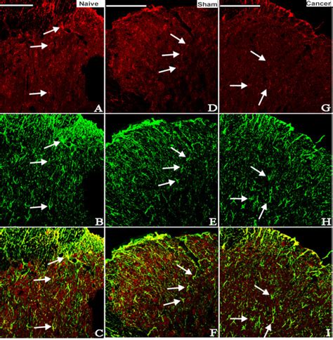 Photomicrographs Showing The Expression Of Gfap Astrocyte Marker