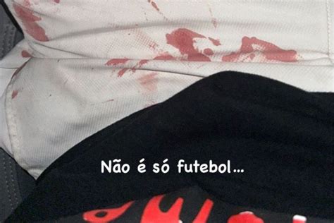 Jogador Luan Agredido Por Torcedores Do Corinthians Em Motel Entenda