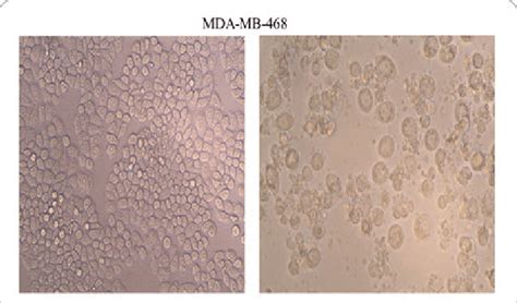 Morphological Assessment Of Untreated And Treated Mda Mb Cells With