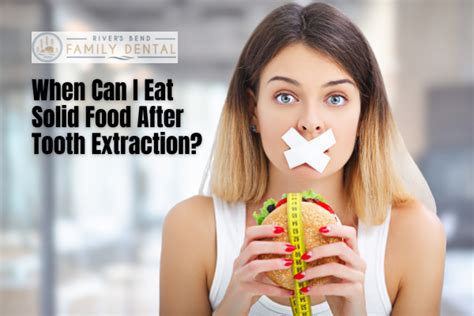 When Can I Eat Solid Food After Tooth Extraction