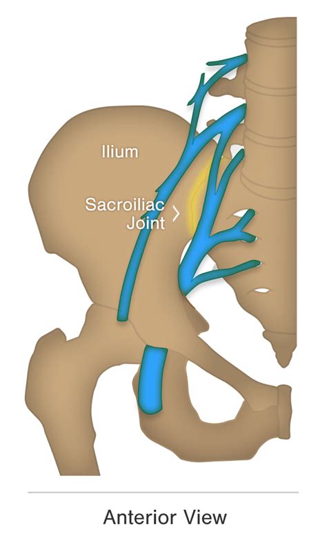 What Does Sacroiliac Joint Pain Feel Like Likewise What Does