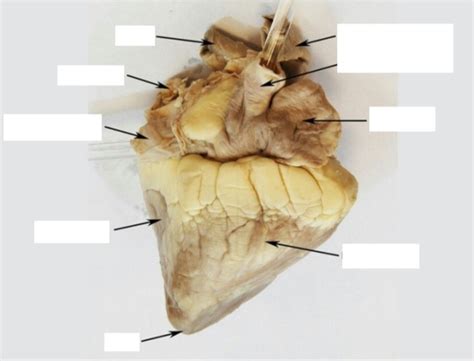 Sheep Heart 2 Diagram Quizlet