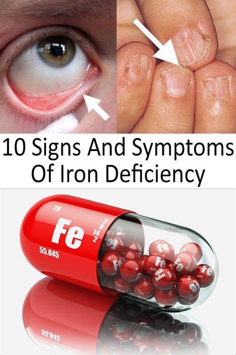 Iron Deficiency Happens When Your Body Doesn’t Have Enough Iron It’s System Your Body Needs