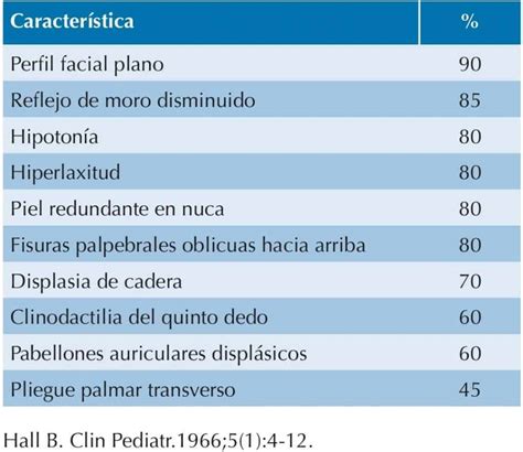 El S Ndrome De Down Curso De Pediatr A Paradigmia