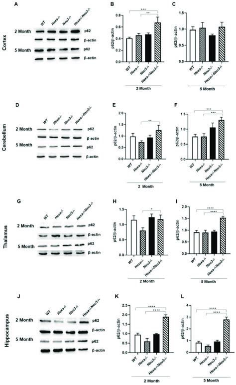 Immunoblot Images And Densitometric Analysis Of Anti P In The Cortex