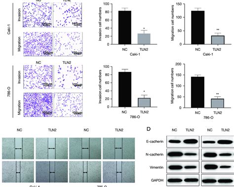 Overexpression Of Tln2 Inhibits Clear Cell Renal Cell Carcinoma Ccrcc Download Scientific