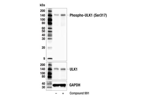 Phospho Ulk1 Ser317 F1z6c Rabbit Mab Cell Signaling Technology