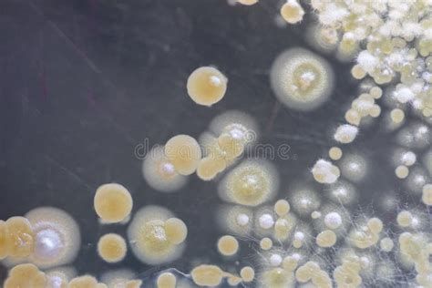 Caracter Stica De La Colonia De Actinomicetos De Bacterias De La