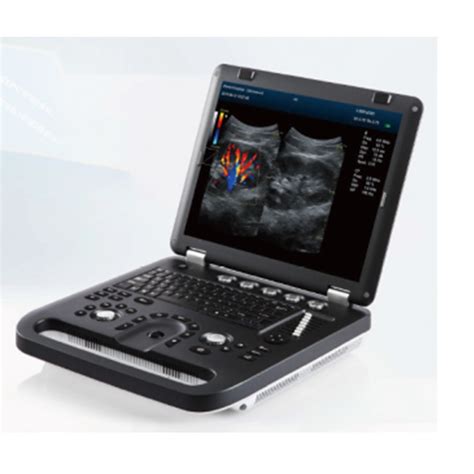 My A E Medical Device Laptop Portable Color Doppler Ultrasound