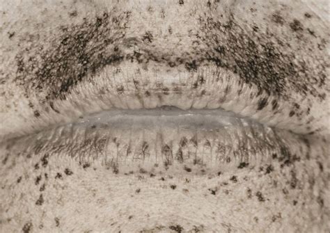 Shocking ultraviolet portraits reveal the real extent of sun damage ...