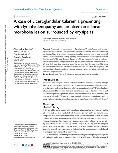 PDF A Case Of Ulceroglandular Tularemia Presenting With